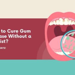 Gum disease remedies credit